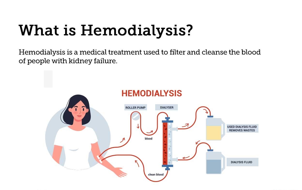 Dialysis Treatment